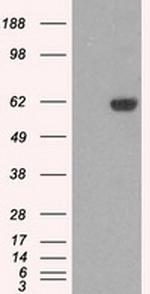 STK39 Antibody in Western Blot (WB)