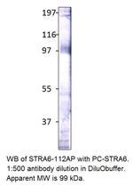 Stra6 Polyclonal Antibody