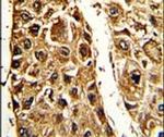 STRA6 Antibody in Immunohistochemistry (IHC)