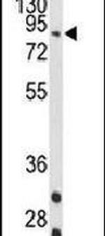 STRA6 Antibody in Western Blot (WB)