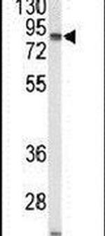 STRA6 Antibody in Western Blot (WB)