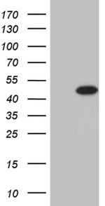 STX18 Antibody in Western Blot (WB)