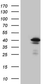 STX18 Antibody in Western Blot (WB)
