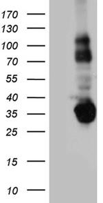 STX3 Antibody in Western Blot (WB)