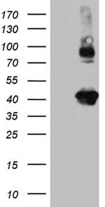STX3 Antibody in Western Blot (WB)
