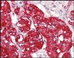 STYK1 Antibody in Immunohistochemistry (Paraffin) (IHC (P))
