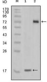 STYK1 Antibody in Western Blot (WB)
