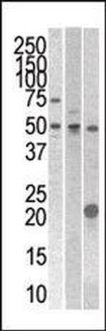 STYK1 Antibody in Western Blot (WB)