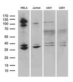 SUGT1 Antibody in Western Blot (WB)