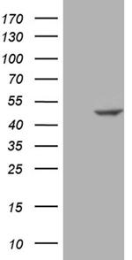 SUGT1 Antibody in Western Blot (WB)
