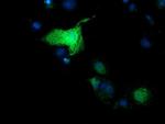 SULT1A1 Antibody in Immunocytochemistry (ICC/IF)