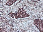 SULT1A1 Antibody in Immunohistochemistry (Paraffin) (IHC (P))