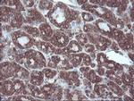 SULT1A1 Antibody in Immunohistochemistry (Paraffin) (IHC (P))