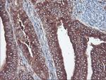 SULT1A1 Antibody in Immunohistochemistry (Paraffin) (IHC (P))