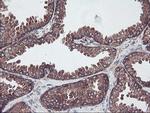 SULT1A1 Antibody in Immunohistochemistry (Paraffin) (IHC (P))