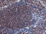 SULT1A1 Antibody in Immunohistochemistry (Paraffin) (IHC (P))