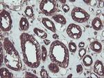 SULT1A1 Antibody in Immunohistochemistry (Paraffin) (IHC (P))