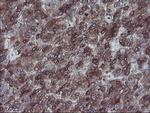 SULT1A1 Antibody in Immunohistochemistry (Paraffin) (IHC (P))