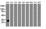 SULT1A1 Antibody in Western Blot (WB)