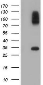 SULT1A1 Antibody in Western Blot (WB)