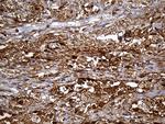 SULT1A3 Antibody in Immunohistochemistry (Paraffin) (IHC (P))