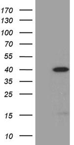 SULT1A3 Antibody in Western Blot (WB)
