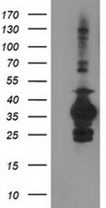 SULT1C2 Antibody in Western Blot (WB)