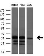 SULT1C2 Antibody in Western Blot (WB)