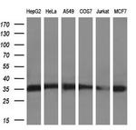 SULT2A1 Antibody in Western Blot (WB)