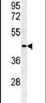 SULT2B1 Antibody in Western Blot (WB)