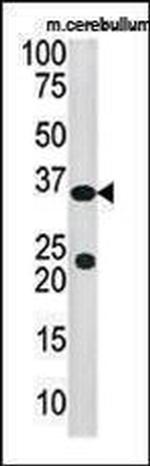 SULT4A1 Antibody in Western Blot (WB)