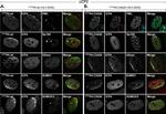 SUMO1 Antibody in Immunocytochemistry (ICC/IF)