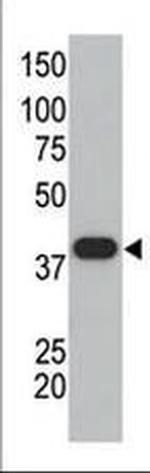SUMO1 Antibody in Western Blot (WB)
