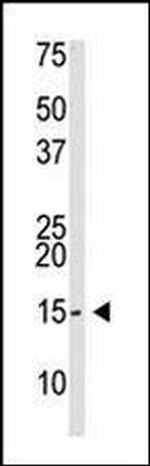 SUMO2/SUMO3 Antibody in Western Blot (WB)