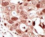 SUMO2 Antibody in Immunohistochemistry (IHC)