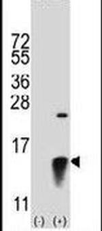 SUMO2 Antibody in Western Blot (WB)