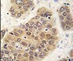 SUMO4 Antibody in Immunohistochemistry (IHC)
