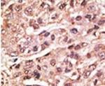 SUMO4 Antibody in Immunohistochemistry (IHC)