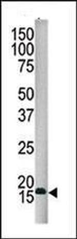 SUMO4 Antibody in Western Blot (WB)