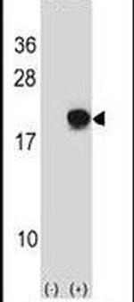 SUMO4 Antibody in Western Blot (WB)