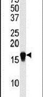 SUMO4 Antibody in Western Blot (WB)