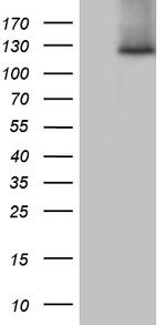 SUPT16H Antibody in Western Blot (WB)