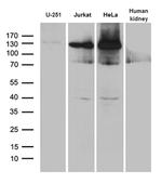 SUPT16H Antibody in Western Blot (WB)