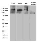 SUPT16H Antibody in Western Blot (WB)