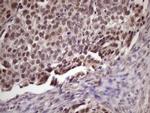 SUPT3H Antibody in Immunohistochemistry (Paraffin) (IHC (P))