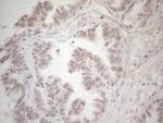 SUPT3H Antibody in Immunohistochemistry (Paraffin) (IHC (P))