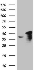 SUPT3H Antibody in Western Blot (WB)