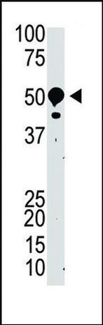 SUV39H2 Antibody in Western Blot (WB)