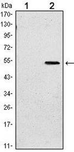 SUZ12 Antibody in Western Blot (WB)