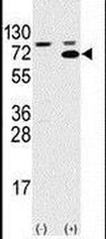SWAP70 Antibody in Western Blot (WB)